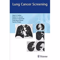 ISBN Lung Cancer Screening, Education, Anglais, Livre broché