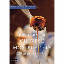 UBC Press Illustrated Chinese Moxibustion Techniques and Methods, Livre broché