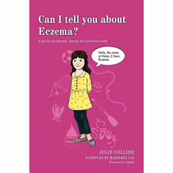 UBC Press Can I tell you about Eczema?, Livre broché
