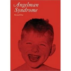 ISBN Angelman Syndrome (Clinics in Developmental Medicine) livre Education Anglais