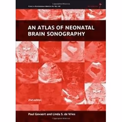 ISBN Atlas of Neonatal Brain Sonography: 182-183 (Clinics in Developmental Medicine), Education, Anglais, Couverture rigide,  ...