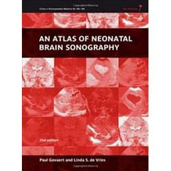 ISBN Atlas of Neonatal Brain Sonography: 182-183 (Clinics in Developmental Medicine) livre Education Anglais Couverture rigide
