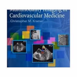 ISBN Multimodality Imaging in Cardiovascular Medicine, Médical, Anglais, Couverture rigide, 350 pages