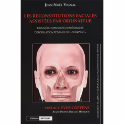 ISBN Les Reconstitutions Faciales Assistées Par Ordinateur, Français, 168 pages