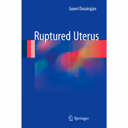 ISBN Ruptured Uterus, Anglais, Couverture rigide, 66 pages