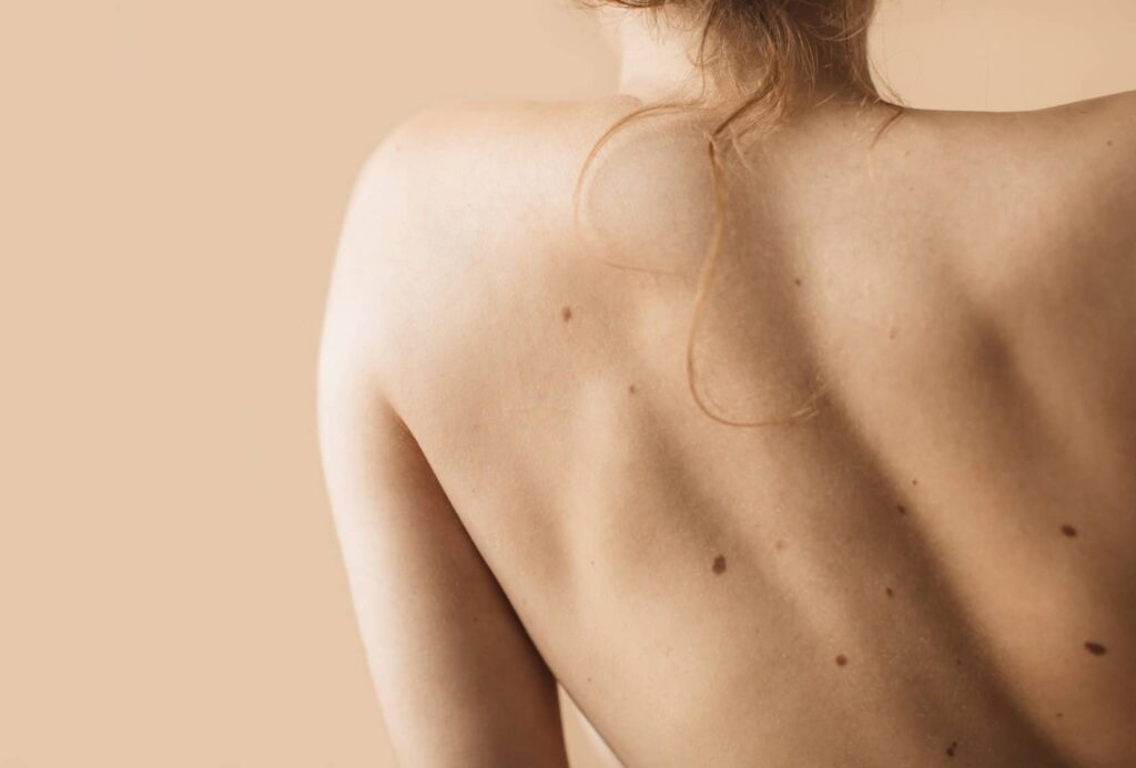 Traitement des problèmes spécifiques de la peau du corps